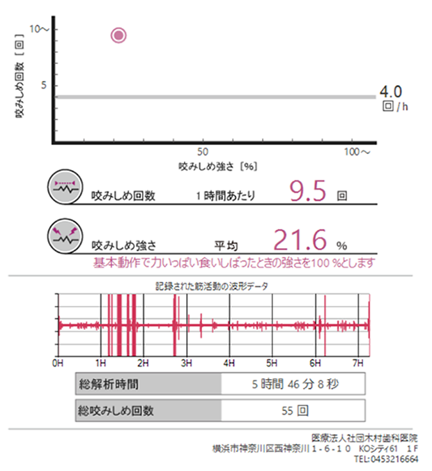 �摜�A�i�}�F�������o�[�X�g�񐔁^��l4��/���ԁj