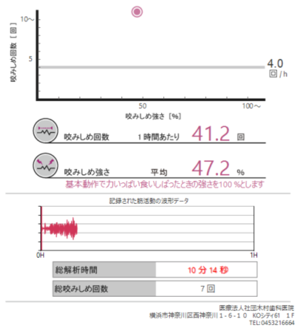 �摜�B�i�𚐎��̗�F��r�I���S�����Ȃ��P�[�X�j 